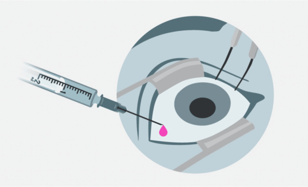 Ravimi Süstimine Klaaskehasse